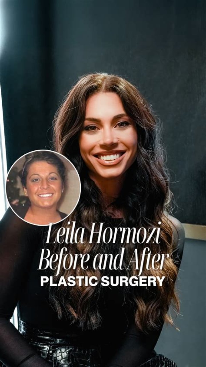 Is Leila Hormozi Transgender? Before Surgery Photos Meet Husband Alex Hormozi