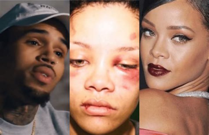 Rihanna Bruised: Uncovering The Hidden Truths