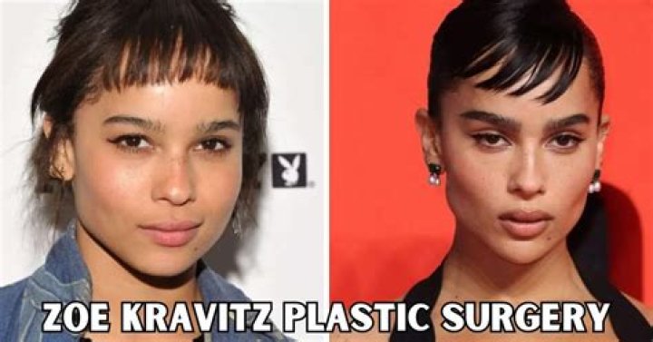 Uncover The Truth Behind Zoe Kravitz's Plastic Surgery Journey